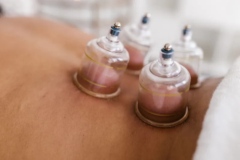Quatre ventouses de cupping en verre posées sur le dos d'une personne allongée.